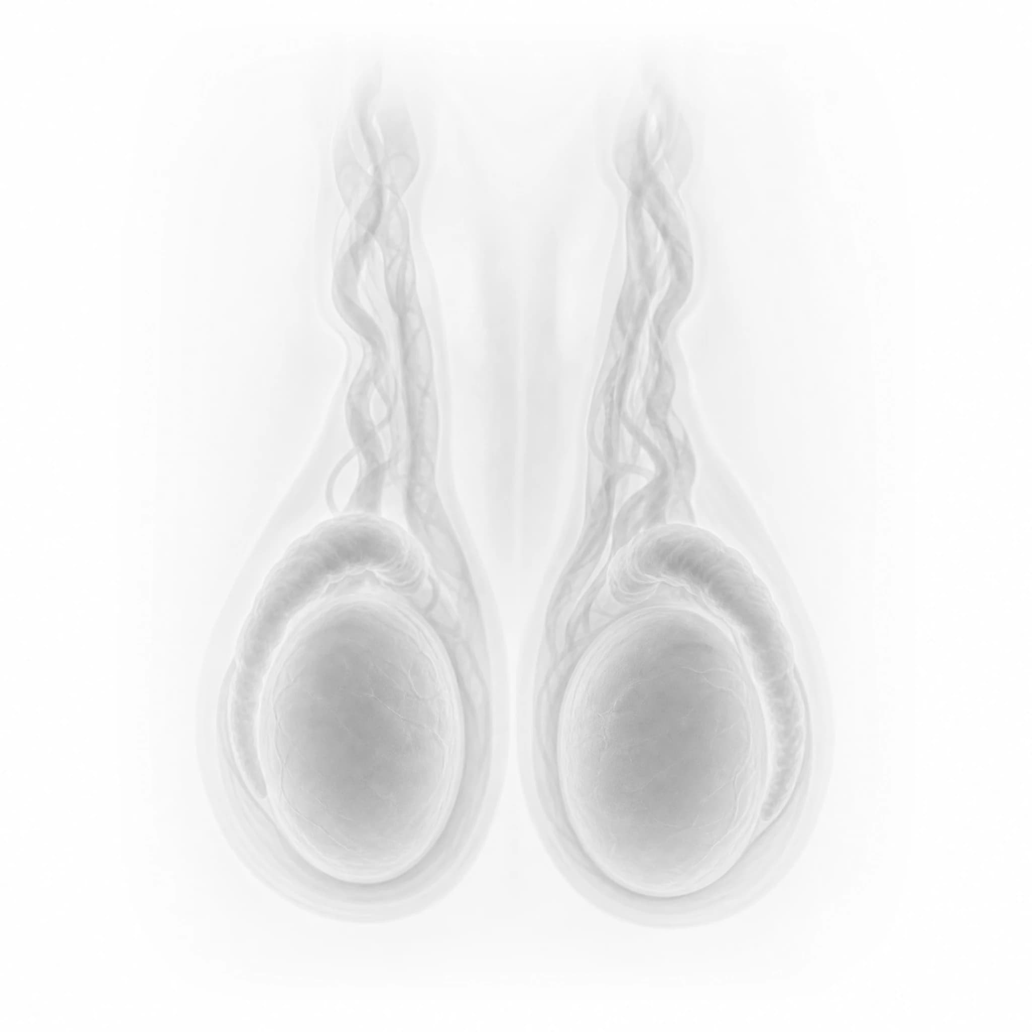 Male reproductive anatomy